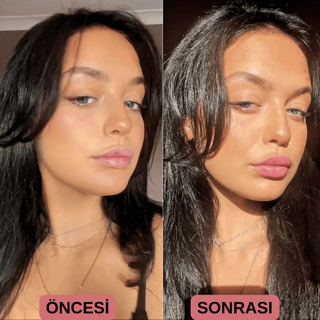 KİSSORA DUDAK DOLGUNLAŞTIRICI KİT